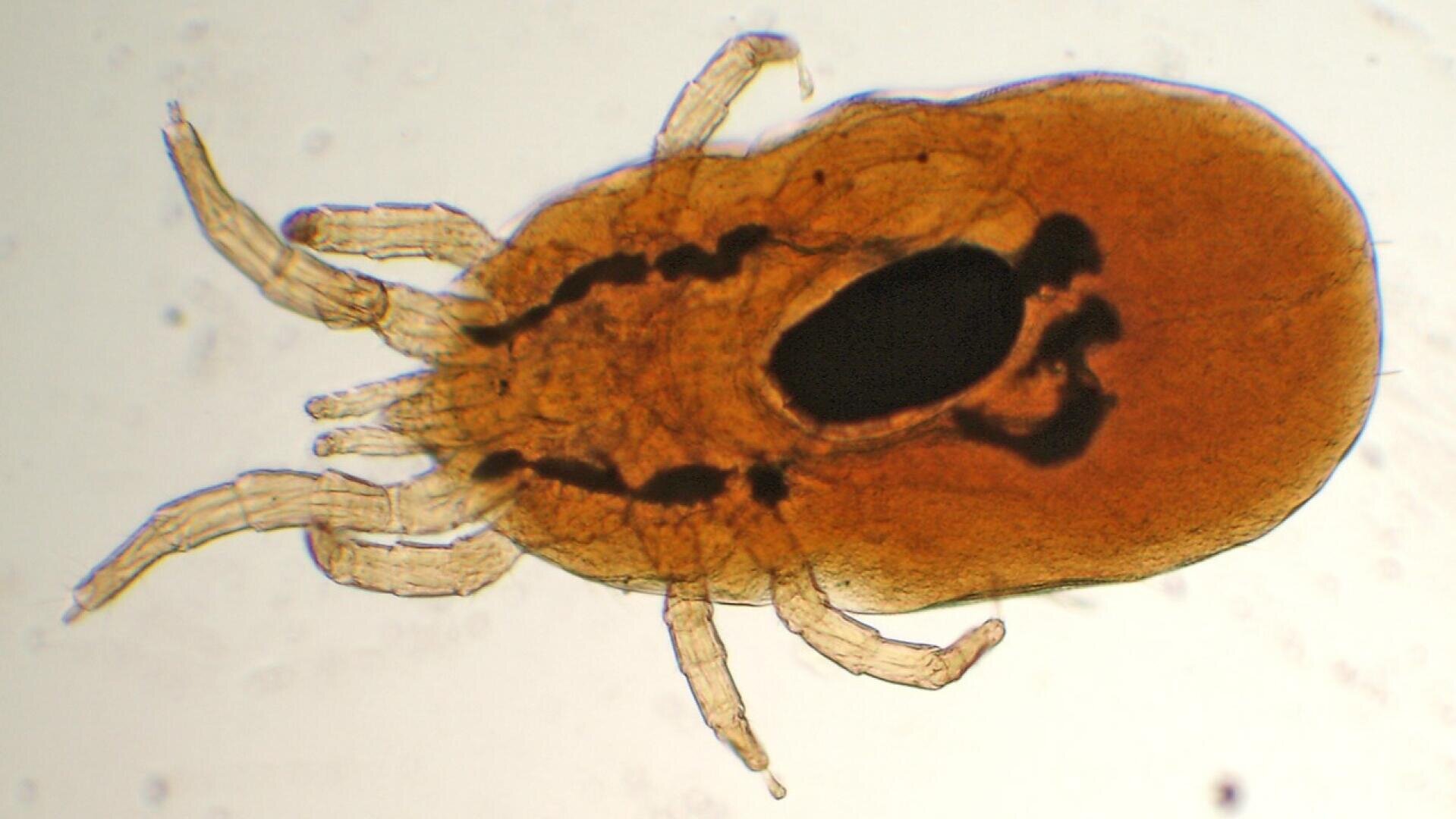 Mikroskopische Nahaufnahme einer braunen Milbe mit acht Beinen, die strahlenförmig von ihrem ovalen Körper ausgehen, vor einem hellen Hintergrund.